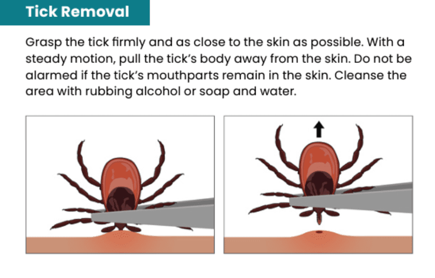 Tick Removal-1